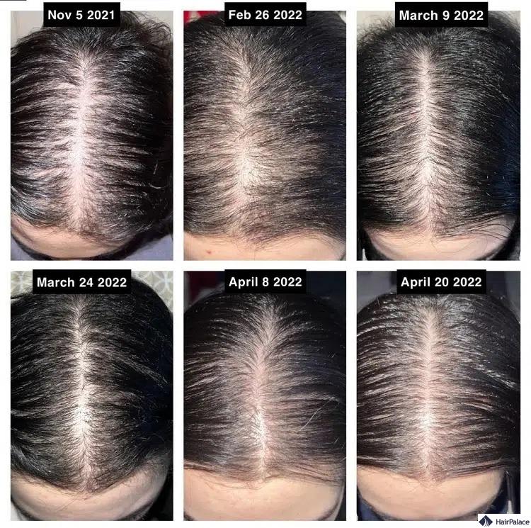 rosmarinöl für haare